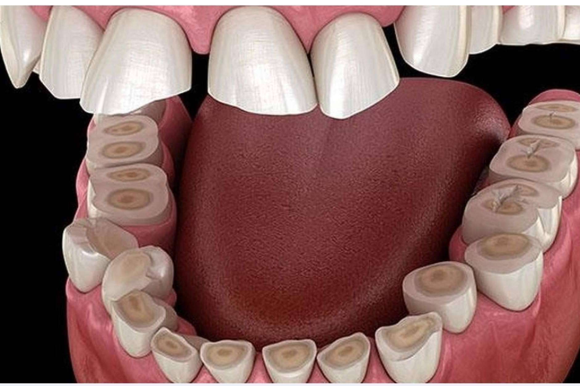 ¿Sangrado de encías? Cómo prevenirlo con Dentinova