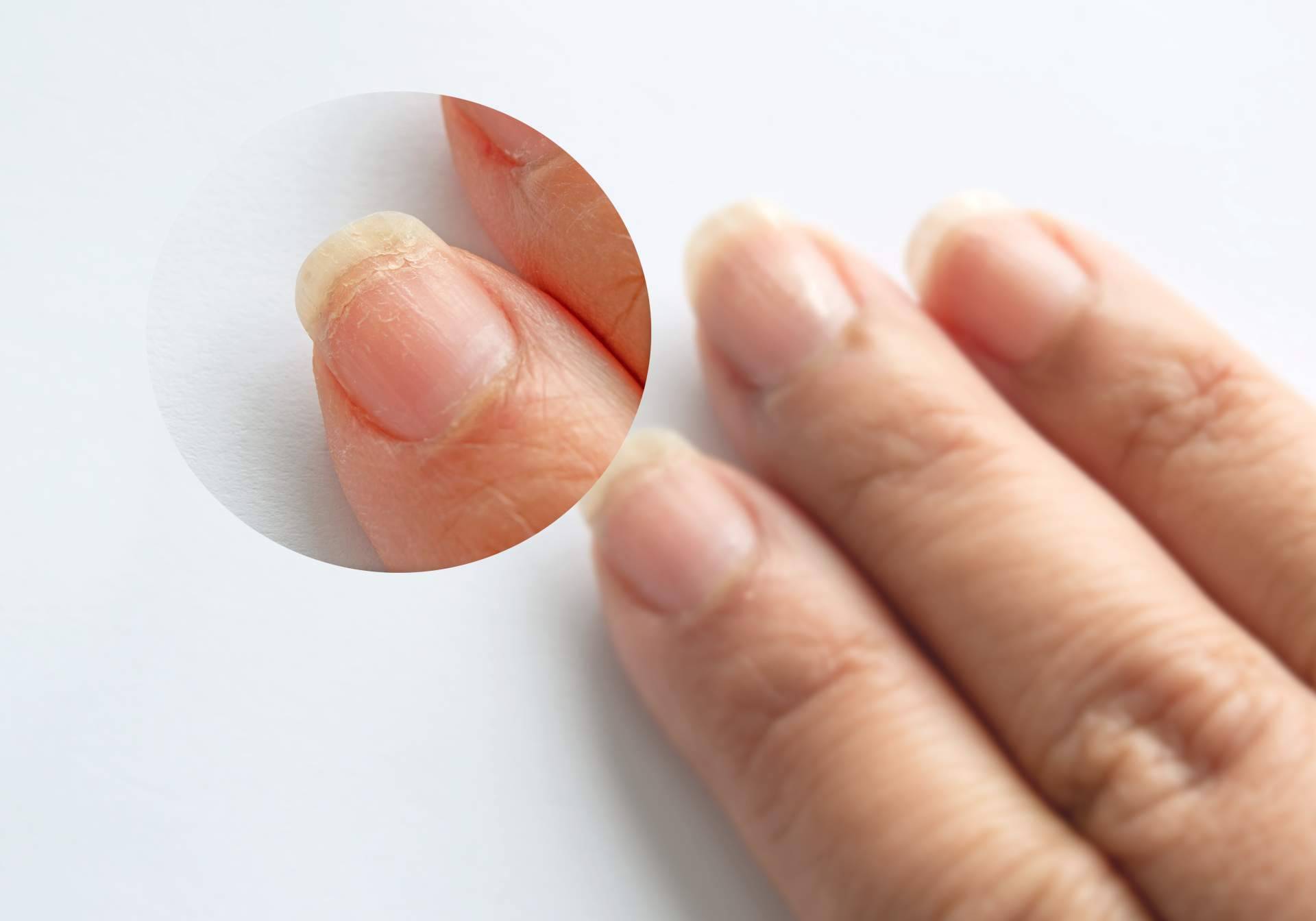 Lazonail®, un tratamiento holístico de uñas y cutículas