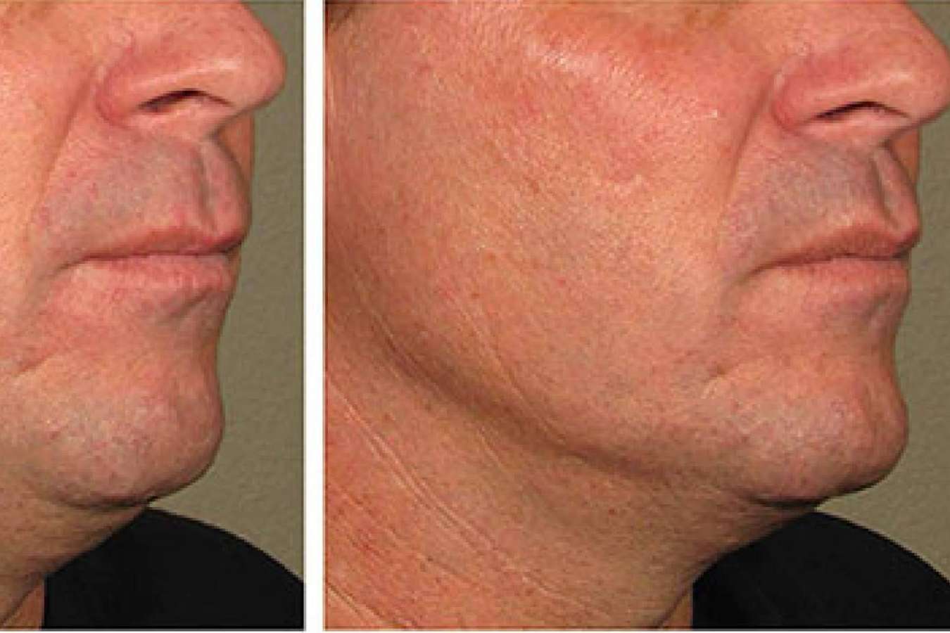 La Clínica Calvo de Mora es una clínica maxilofacial especializada en cirugías ortognáticas