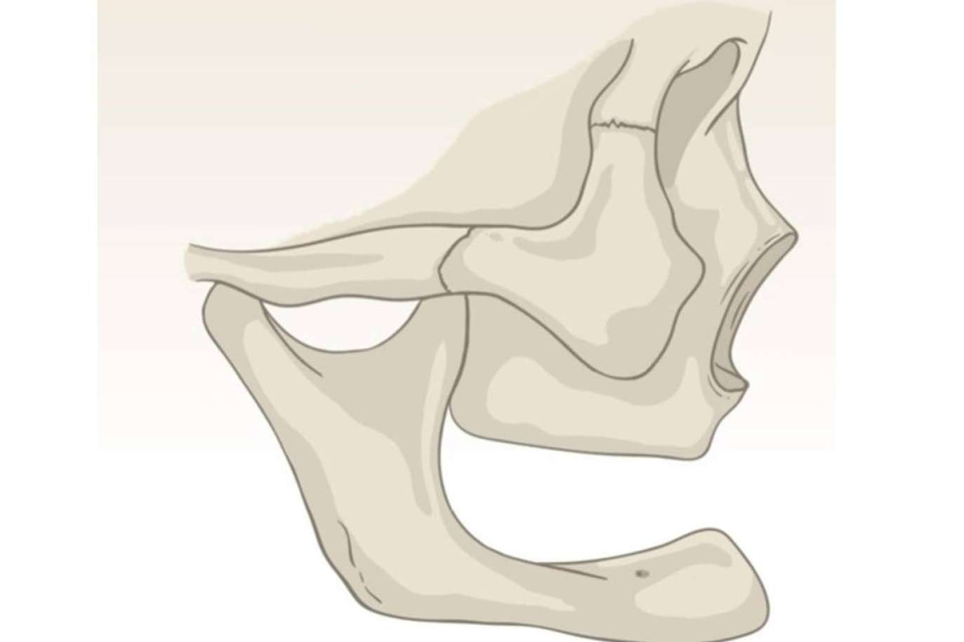 Innovación tecnológica y enfoque multidisciplinar para tratar la atrofia severa de hueso maxilar y mandibular