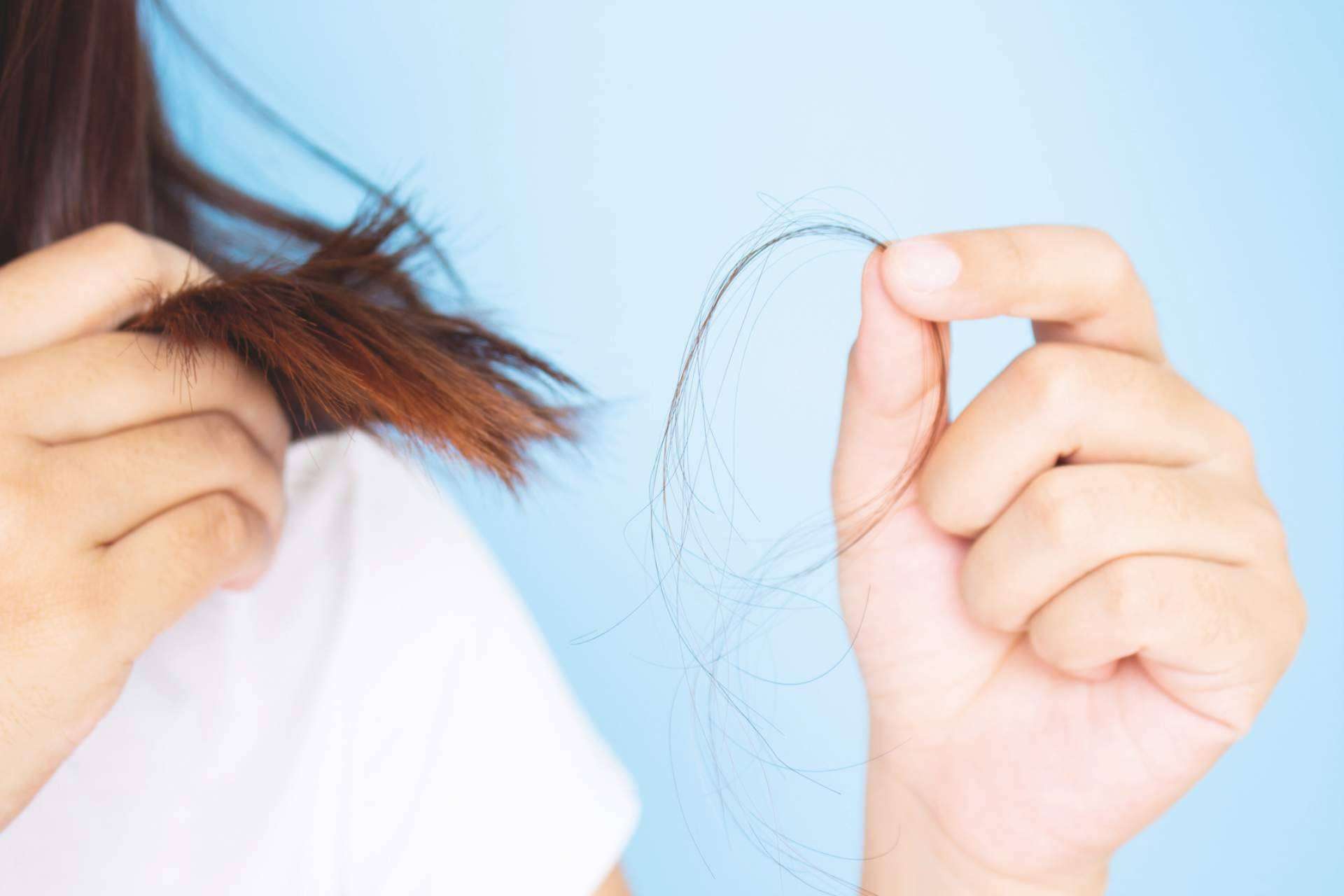 Tipos de alopecia, características y señales distintivas