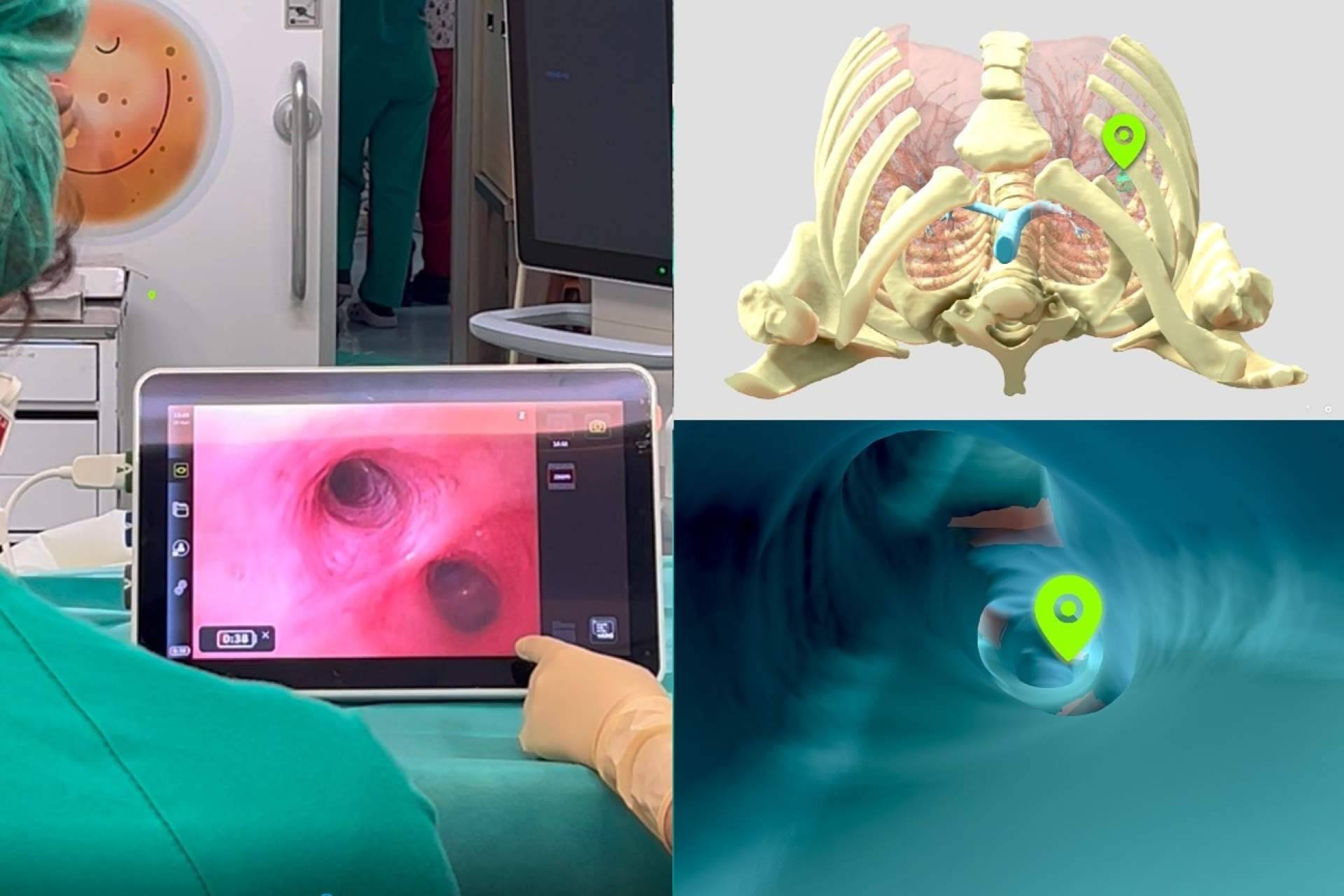 El Hospital Universitario La Paz integra ingeniería clínica en el quirófano para cirugía torácica pediátrica con navegación virtual