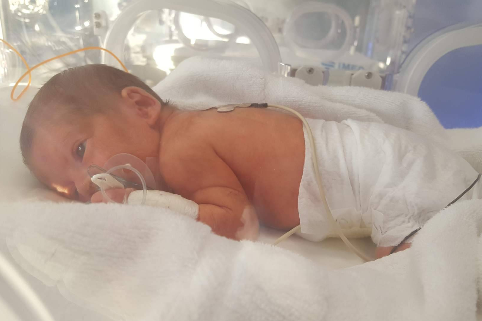 Cada bebé prematuro, una historia de lucha familiar en el Día Mundial de la Prematuridad