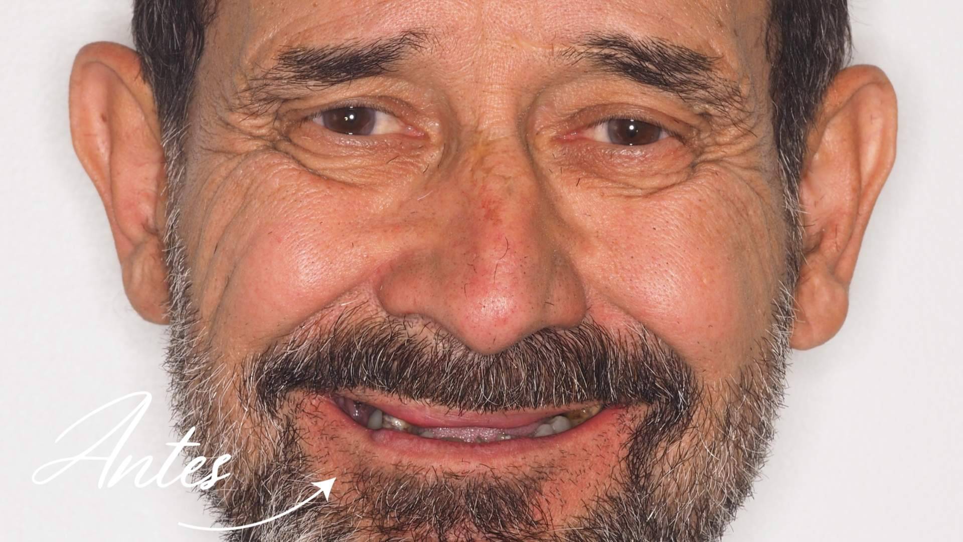 Clínica Calvo de Mora se consolida como referente en cirugía maxilofacial e implantología dental avanzada en Madrid